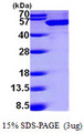 DDX39B / UAP56 Protein