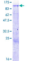 DDX3Y Protein - 12.5% SDS-PAGE of human DDX3Y stained with Coomassie Blue
