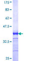 DDX3Y Protein - 12.5% SDS-PAGE Stained with Coomassie Blue.