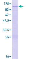 DDX41 / ABS Protein - 12.5% SDS-PAGE of human DDX41 stained with Coomassie Blue