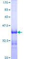 DDX41 / ABS Protein - 12.5% SDS-PAGE Stained with Coomassie Blue.