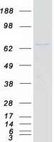 DDX41 / ABS Protein - Purified recombinant protein DDX41 was analyzed by SDS-PAGE gel and Coomassie Blue Staining