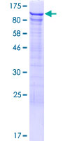 DDX42 Protein - 12.5% SDS-PAGE of human DDX42 stained with Coomassie Blue