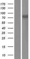 DDX43 Protein - Western validation with an anti-DDK antibody * L: Control HEK293 lysate R: Over-expression lysate