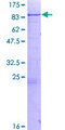 DDX43 Protein - 12.5% SDS-PAGE of human DDX43 stained with Coomassie Blue