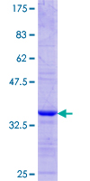 DDX43 Protein - 12.5% SDS-PAGE Stained with Coomassie Blue.