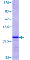 DDX43 Protein - 12.5% SDS-PAGE Stained with Coomassie Blue.