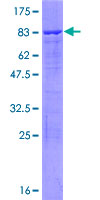 DDX47 Protein - 12.5% SDS-PAGE of human DDX47 stained with Coomassie Blue