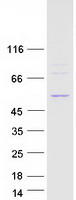 DDX47 Protein - Purified recombinant protein DDX47 was analyzed by SDS-PAGE gel and Coomassie Blue Staining