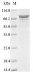 DDX5 Protein - (Tris-Glycine gel) Discontinuous SDS-PAGE (reduced) with 5% enrichment gel and 15% separation gel.