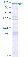 DDX50 Protein - 12.5% SDS-PAGE of human DDX50 stained with Coomassie Blue