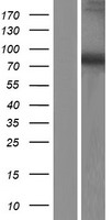 DDX51 Protein - Western validation with an anti-DDK antibody * L: Control HEK293 lysate R: Over-expression lysate