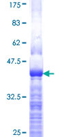 DDX56 Protein - 12.5% SDS-PAGE Stained with Coomassie Blue.