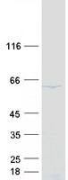 DDX56 Protein - Purified recombinant protein DDX56 was analyzed by SDS-PAGE gel and Coomassie Blue Staining