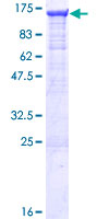 DDX58 / RIG-1 / RIG-I Protein - 12.5% SDS-PAGE of human DDX58 stained with Coomassie Blue