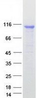 DDX58 / RIG-1 / RIG-I Protein - Purified recombinant protein DDX58 was analyzed by SDS-PAGE gel and Coomassie Blue Staining
