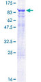 DDX59 Protein - 12.5% SDS-PAGE of human DDX59 stained with Coomassie Blue