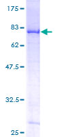 DDX6 Protein - 12.5% SDS-PAGE of human DDX6 stained with Coomassie Blue
