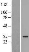 DECR1 Protein - Western validation with an anti-DDK antibody * L: Control HEK293 lysate R: Over-expression lysate