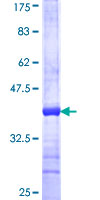 DECR1 Protein - 12.5% SDS-PAGE Stained with Coomassie Blue.