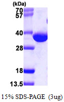 DECR1 Protein