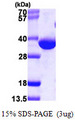 DECR1 Protein