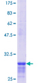 DECR2 Protein - 12.5% SDS-PAGE Stained with Coomassie Blue.