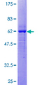 DEDD Protein - 12.5% SDS-PAGE of human DEDD stained with Coomassie Blue