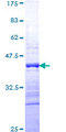 DEDD Protein - 12.5% SDS-PAGE Stained with Coomassie Blue.