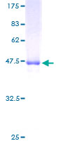 DEF8 Protein - 12.5% SDS-PAGE of human FLJ20186 stained with Coomassie Blue