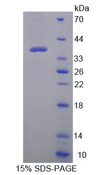 DEFA1 / Defensin Alpha 1 Protein - Recombinant  Defensin Alpha 2 By SDS-PAGE