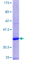 DEFA3 / Defensin Alpha 3 Protein - 12.5% SDS-PAGE of human DEFA3 stained with Coomassie Blue