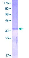 DEFA5 / Defensin 5 Protein - 12.5% SDS-PAGE of human DEFA5 stained with Coomassie Blue