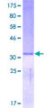 DEFA5 / Defensin 5 Protein - 12.5% SDS-PAGE of human DEFA5 stained with Coomassie Blue
