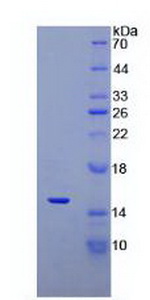 DEFA5 / Defensin 5 Protein - Recombinant Defensin Alpha 5, Paneth Cell Specific By SDS-PAGE