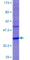 DEFA6 / Defensin 6 Protein - 12.5% SDS-PAGE of human DEFA6 stained with Coomassie Blue