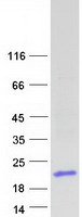 DEFA6 / Defensin 6 Protein - Purified recombinant protein DEFA6 was analyzed by SDS-PAGE gel and Coomassie Blue Staining