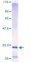 DEFB1 / BD-1 Protein - 12.5% SDS-PAGE of human DEFB1 stained with Coomassie Blue
