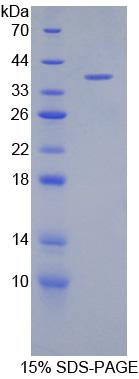 DEFB1 / BD-1 Protein - Recombinant Defensin Beta 1 By SDS-PAGE
