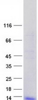 DEFB1 / BD-1 Protein - Purified recombinant protein DEFB1 was analyzed by SDS-PAGE gel and Coomassie Blue Staining