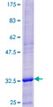 DEFB103A / BD-3 Protein - 12.5% SDS-PAGE of human DEFB103A stained with Coomassie Blue