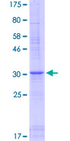 DEFB110 Protein - 12.5% SDS-PAGE of human DEFB110 stained with Coomassie Blue