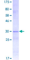 DEFB112 Protein - 12.5% SDS-PAGE of human DEFB112 stained with Coomassie Blue