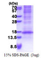 DEFB116 Protein