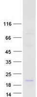 DEFB118 Protein - Purified recombinant protein DEFB118 was analyzed by SDS-PAGE gel and Coomassie Blue Staining