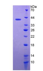 DEFB119 Protein - Recombinant Defensin Beta 119 By SDS-PAGE