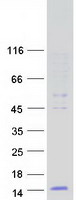 DEFB124 Protein - Purified recombinant protein DEFB124 was analyzed by SDS-PAGE gel and Coomassie Blue Staining