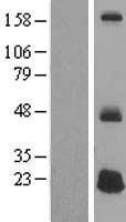 DEFB125 Protein - Western validation with an anti-DDK antibody * L: Control HEK293 lysate R: Over-expression lysate