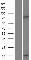 DEFB132 Protein - Western validation with an anti-DDK antibody * L: Control HEK293 lysate R: Over-expression lysate