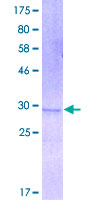 DEFB4A / BD-2 Protein - 12.5% SDS-PAGE of human DEFB4 stained with Coomassie Blue